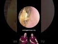 Ear Wax Rolled In Dust