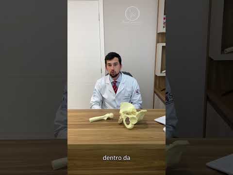 Thumbnail do vídeo Impacto Femoroacetabular