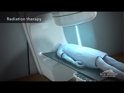 Radiation therapy session for colon cancer patient