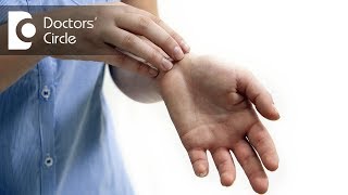 How to treat rashes on hands? - Dr. Rasya Dixit