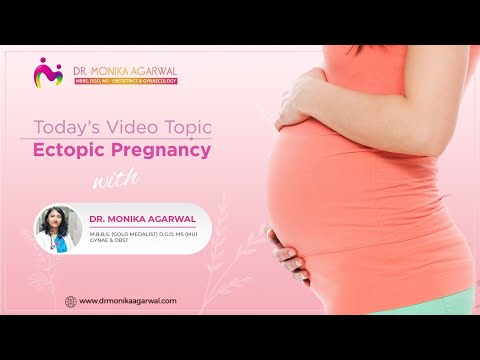 Ectopic Pregnancy - Dr. Monika Agarwal