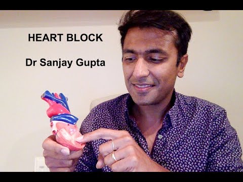 Heart block