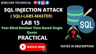 sql injection vulnerability | attack | #part15