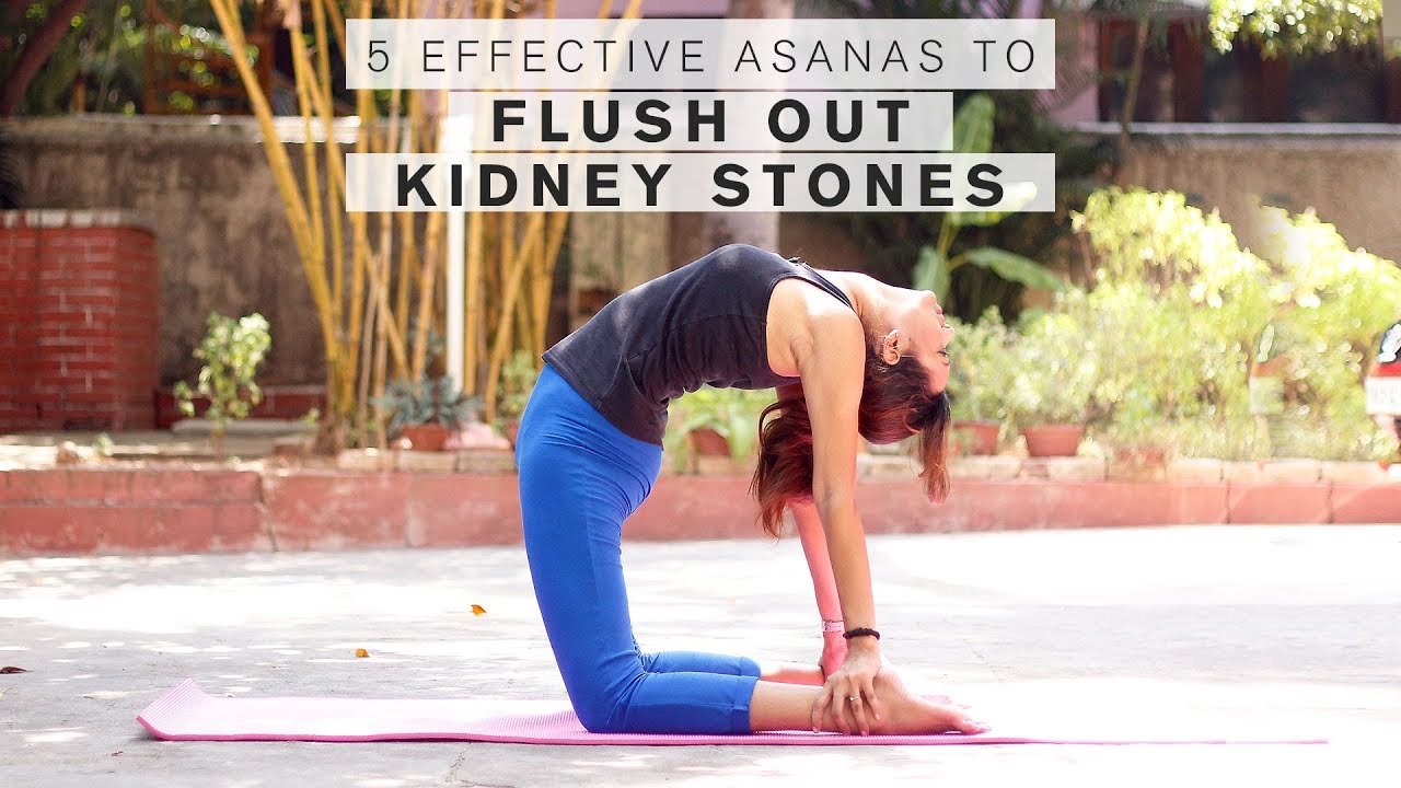 Which exercise is good for kidney stone?