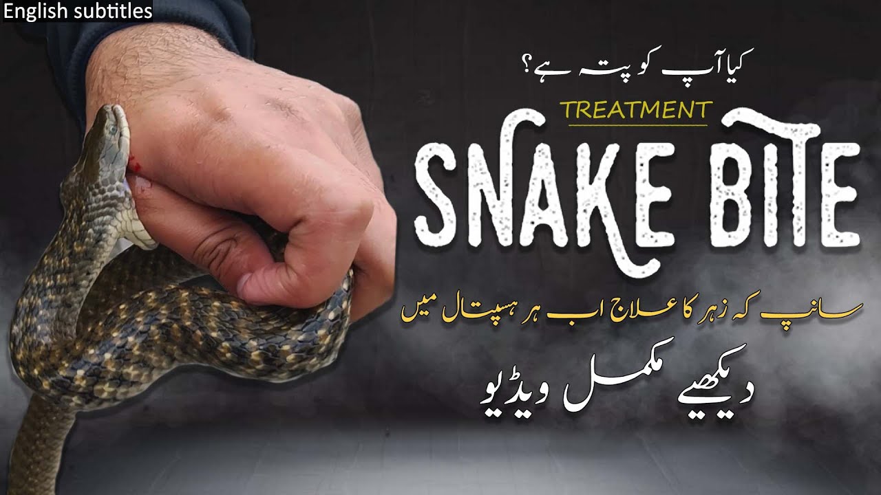 Snake antivenom treatment guide Pakistan