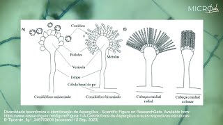 Como fazer/ler laminas de fungos: identificando fungos na prática | microbiology lab work