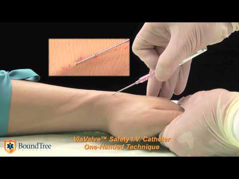 ViaValve™ One-Handed Technique