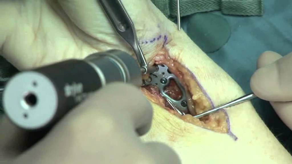 Ernesto Che Jiménez Macedo-8