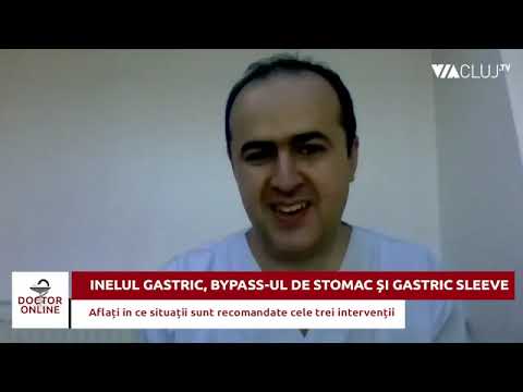 Inelul gastric, bypass-ul de stomac și gastric sleeve