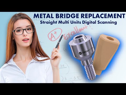 Screw Retained restoration on Straight Multi Units Digital Scanning Metal bridge replacement