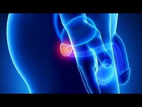 BPH, Finasterid Behandlung von Prostata-Krebs Volksmedizin