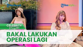 8 Kali Jalani Tindakan Operasi, Lucinta Luna Mengaku Bakal Lakukan Lagi seusai Wajahnya Sembuh Total