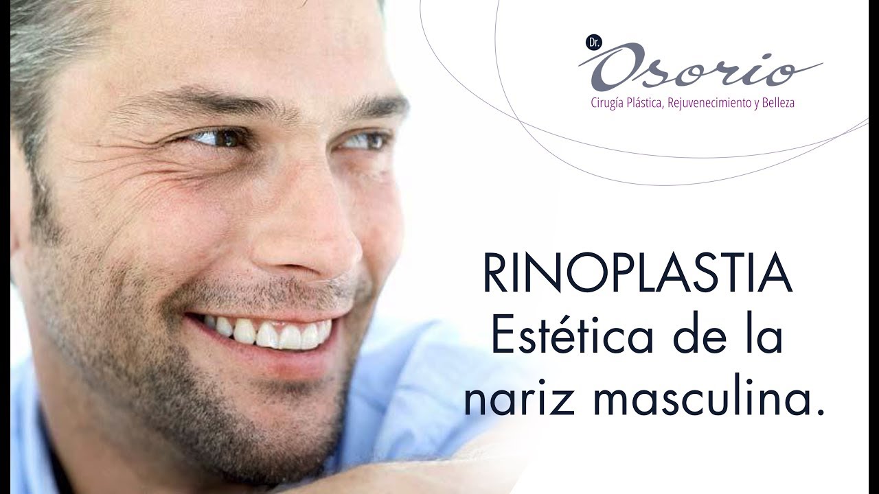 Rinoplastia capítulo 2. Estética de la nariz masculina.