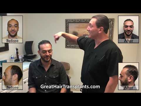 Dr. Brett Bolton Patient Karim travels from Egypt for a MaxHarvest&trade; procedure