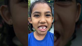 Download lagu Ashna Ke Do Daant 🦷 toot gye 🤣🤣 comedy #shorts #funny #reels #viralvideo mp3 Download lagu Ashna Ke Do Daant 🦷 toot gye 🤣🤣 comedy #shorts #funny #reels #viralvideo mp3