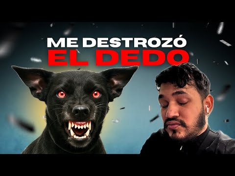 THIS DOG BITES MY FINGER🚨 HE GETS TOO CRAZY ⚠️