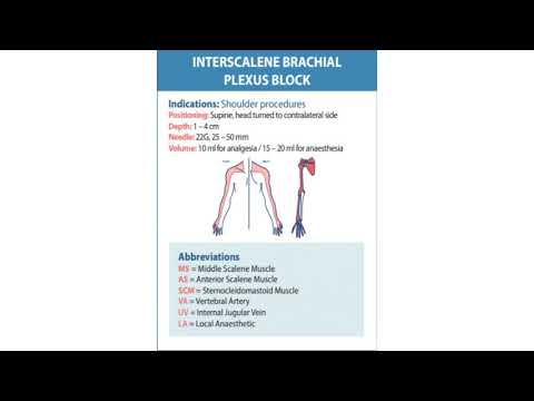 Interscalene Block for Shoulder Surgery #Anaesthesia