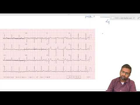 ECG PART 5- RATE, RHYTHM AND AXIS.