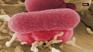 The dangers of E coli Mp4 3GP & Mp3