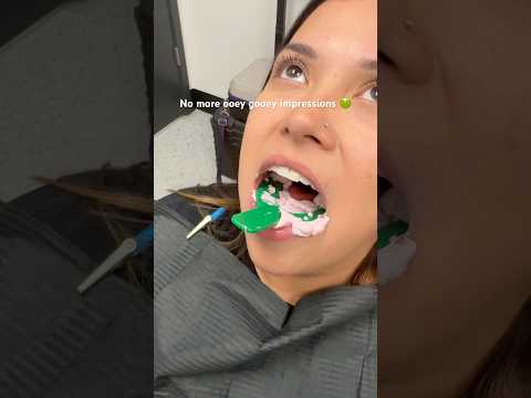 Dentists: Get rid of messy impressions 🤢 call to find out how