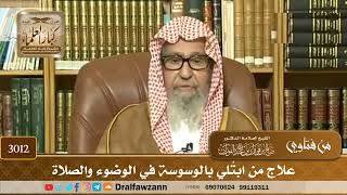 3012- علاج من ابتُلي بالوسوسة في الوضوء والصلاة | الشيخ صالح الفوزان