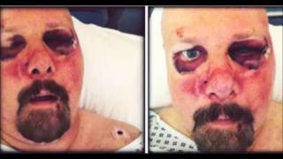 Pro-Pain&#39;s Gary Meskil almost beaten to death releases statement ...