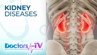 Download lagu Kidney Diseases | Doctors on TV mp3 Download lagu Kidney Diseases | Doctors on TV mp3
