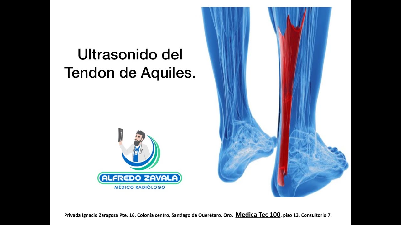 Alfredo Zavala Pardo-27