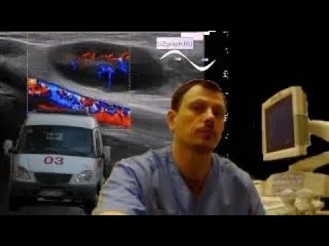 Pediatric Soft tissue ultrasound - acute destructive lymphadenitis