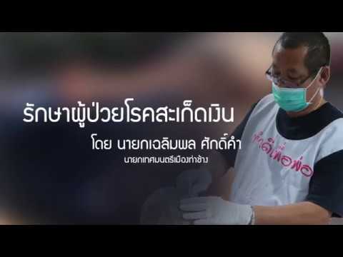 จำพวกกลาก Yiganerjing โรคสะเก็ดเงิน