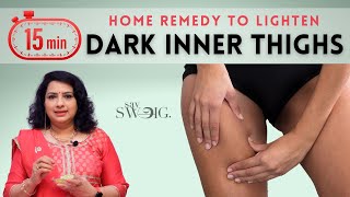 One "Secret Ingredient" To Lighten Dark Inner Thighs Fast | Natural Home Remedies | Vasundhara Tips