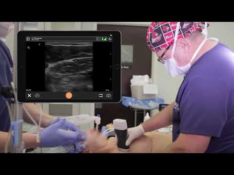 Pectoralis Nerve Block