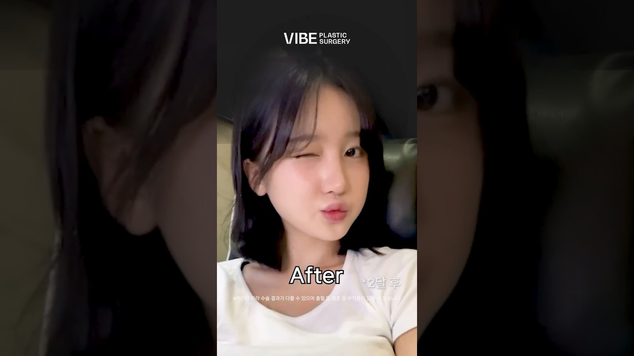 성형하고 남친생겼어요✨ 자세한 내용은 연관영상 클릭!
