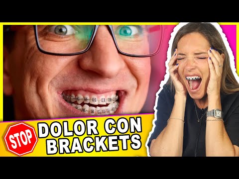 Aprende Como QUITAR el 𝗗𝗢𝗟𝗢𝗥 cuando te ponen BRACKETS (+ CURAR las llagas EN LA BOCA por ortodoncia)