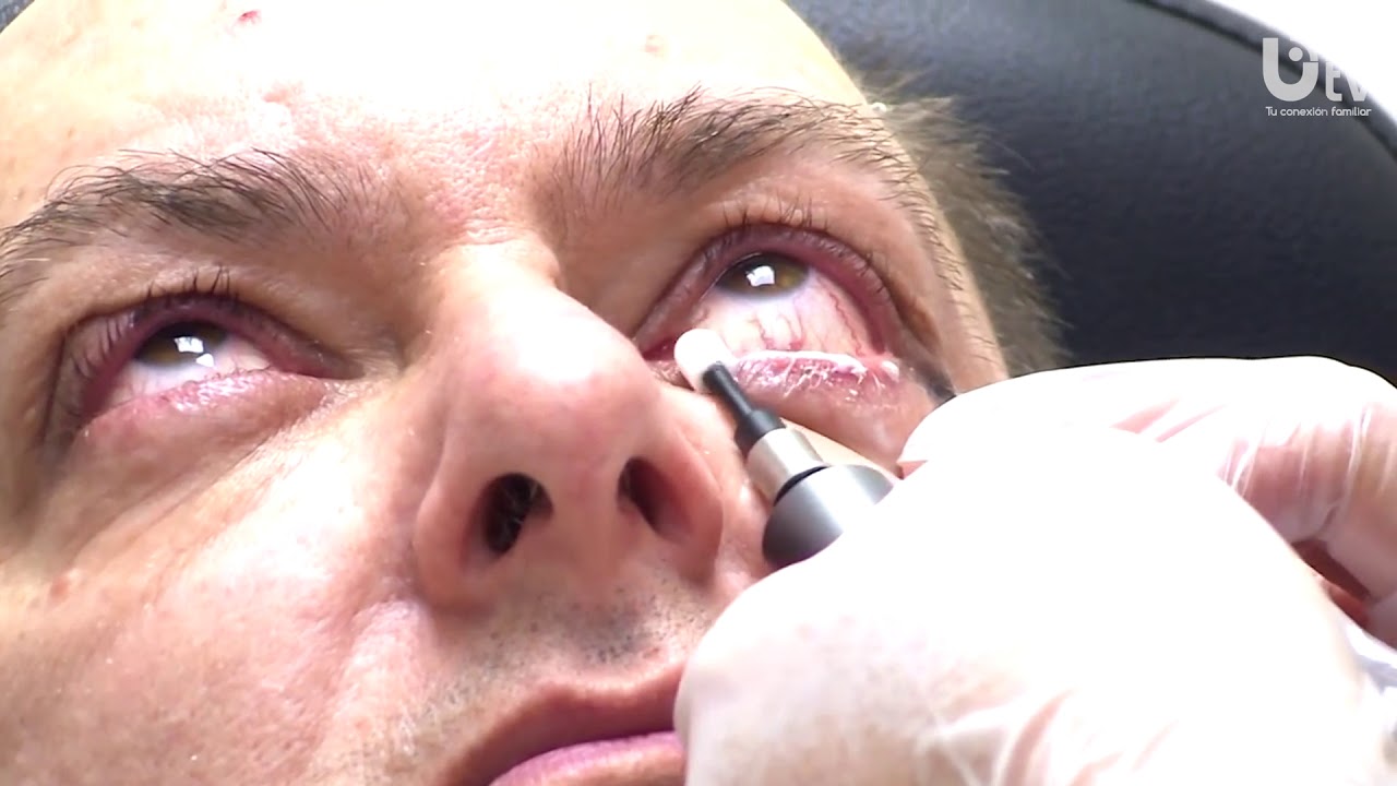 Edgar Angel Hidalgo Pecho-40