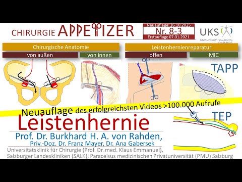 Inguinal hernia (TAPP, TEP, Shouldice, Lichtenstein) SURGERY APPetizer No. 8-3
