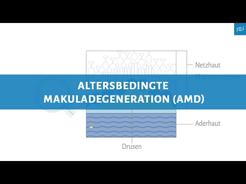 Altersbedingte Makuladegeneration (AMD) - Erklärvideo  - Übersicht