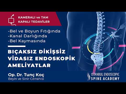 Bıçaksız Dikişsiz ve Vidası Ameliyat Tekniği: Endoskopi