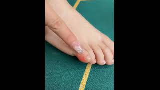 Product Link on Screen1️⃣ Easy Care Silicone Gel Foot Protector
