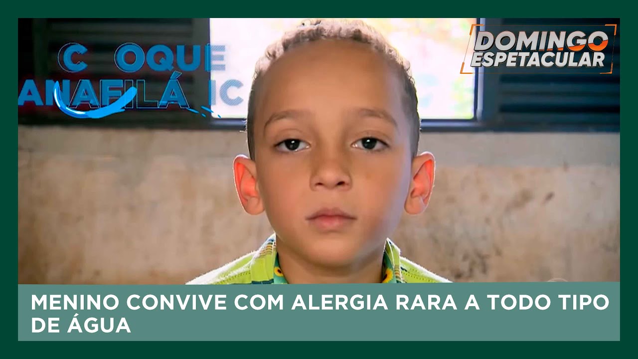 Caso raro: O Menino que tem alergia a todo tipo de água | Domingo Espetacular