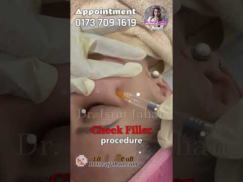 Cheek augmentation is to add volume or lift to the cheek - Dr. Israt Jahan