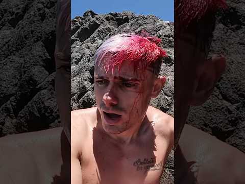 Se quedó dormida al volante y despertó en el hospital sin recordar nada del accidente. Su iPhone había hecho algo mientras estaba inconsciente que le salvó la vida