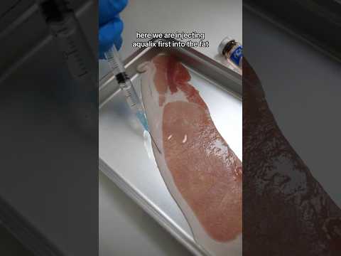 LEMON BOTTLE FAT DISSOLVING INJECTIONS at Bond Dental London #fatdissolving #dentist #doctor#fatloss