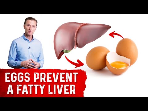 Eat Eggs and Butter and Lower Your Cholesterol