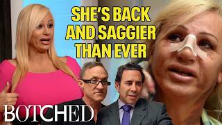 Lacey Stuck A Needle in Her OWN Neck After Her Facelift! (Before & After) | Botched | E!