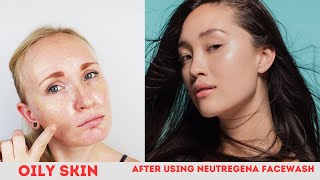 তৈলাক্ত ত্বকের জন্য কোন ফেসওয়াস ভালো। Best face wash for oily skin 2023.