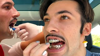 Replacing My Teeth With Metal Chompers