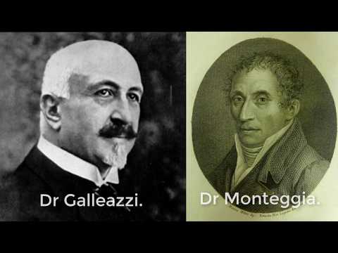Galleazzi and Monteggia fracture dislocations