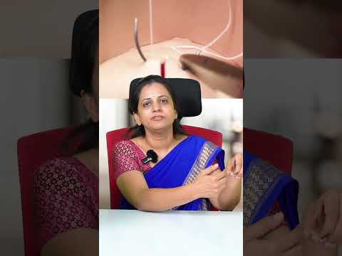 How Many Stitches Do You Get During Normal Delivery? | Essential Tips! | Dr Shilpa GB