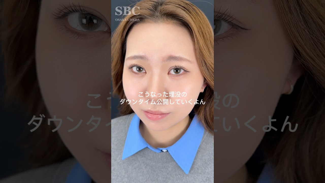 可愛すぎて滅✌🏻💖#二重 #二重埋没法 #二重整形 #埋没 #クイックコスメティーク